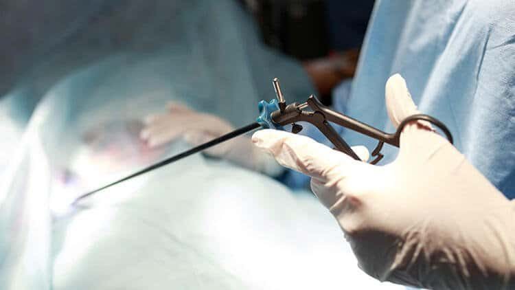 laparoskopi iyilesme sureci nasildir